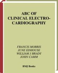 ABC of clinical electrocardiography