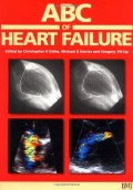 ABC of heart failure, History and epidemiology